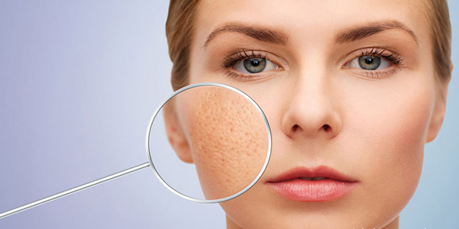 Việc lựa chọn và tìm kiếm cách se khít lỗ chân lông hiệu quả phù hợp với loại da của mình vốn dĩ không phải là chuyện dễ dàng.