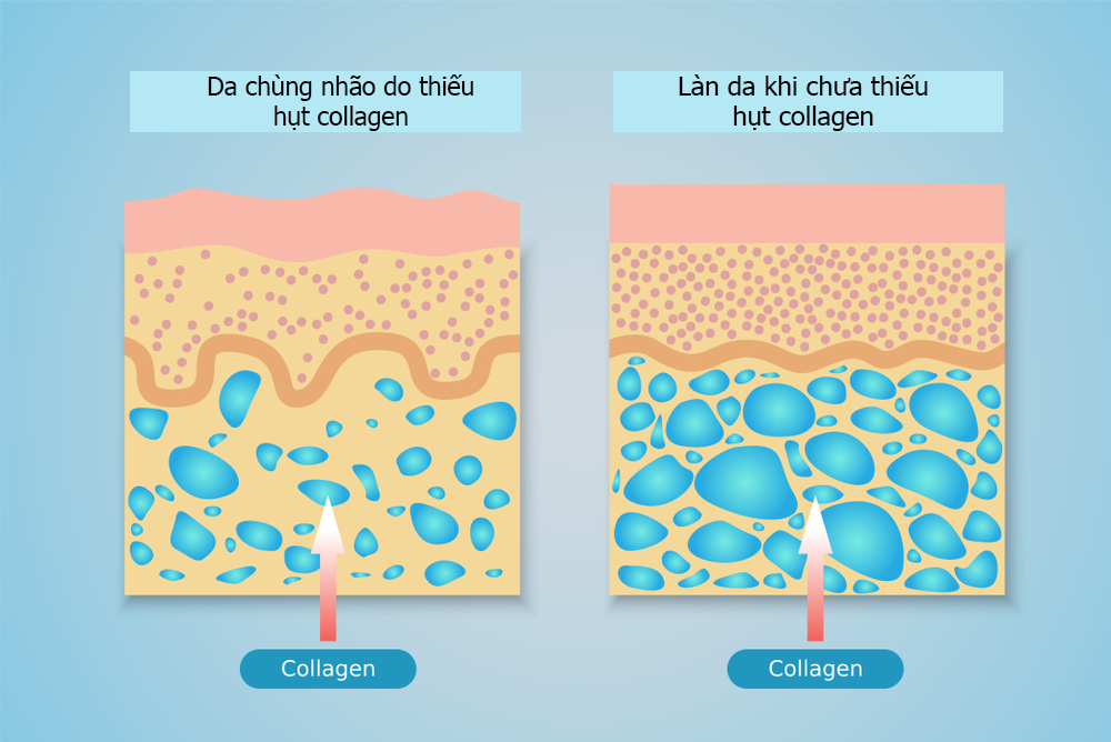 Bước sang tuổi 25, collagen trong cơ thể suy giảm dần 1% mỗi năm