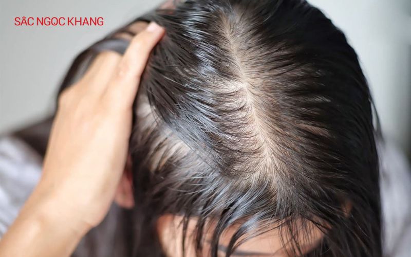 Bổ sung Collagen cải thiện tình trạng tóc mỏng hiệu quả