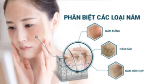 nám nội tiết