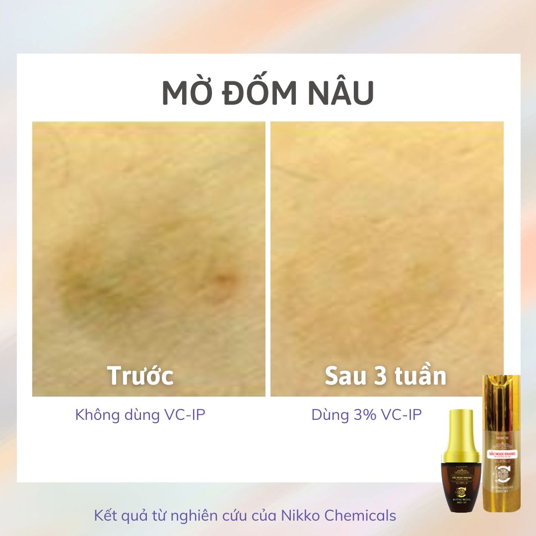 VC-IP