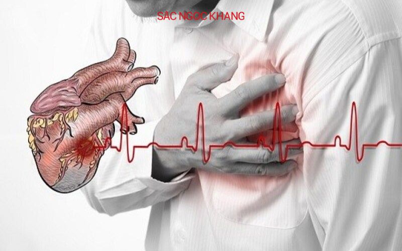 Nhồi máu cơ tim có nguy hiểm không