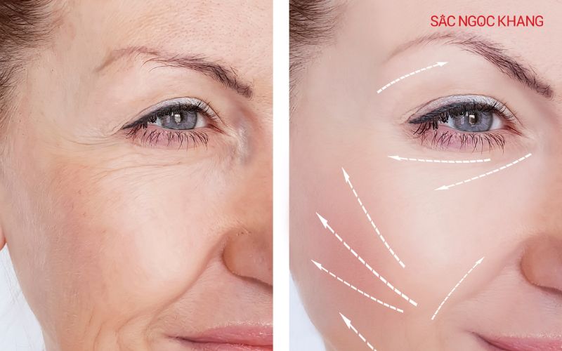 Khi da được cấp ẩm đầy đủ, các tế bào da sẽ căng mọng