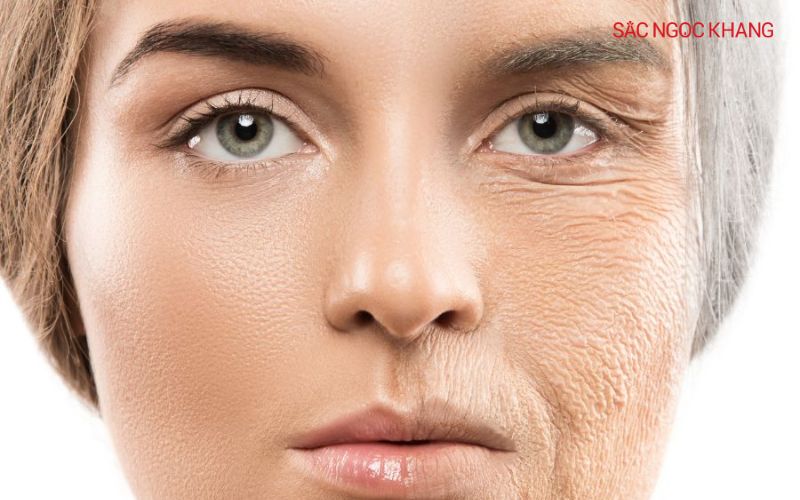 Làn da mất đi độ đàn hồi và sức sống