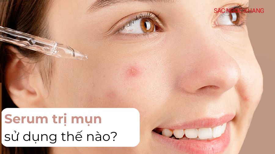 Serum trị mụn là gì? Chi tiết từ A - Z