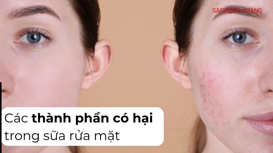 Cẩn thận với các thành phần có hại trong sữa rửa mặt