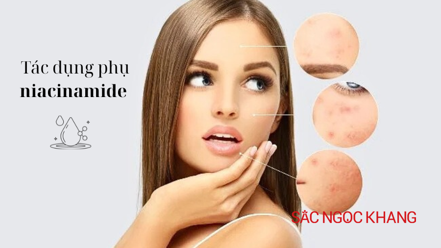 Tác Dụng Phụ Niacinamide Nồng Độ Cao