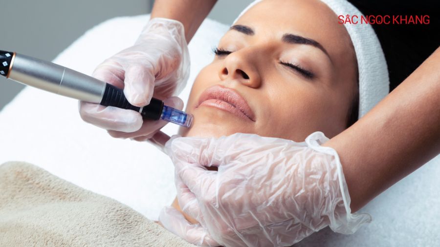 Lăn kim/Phi kim kích thích quá trình sản sinh collagen và elastin