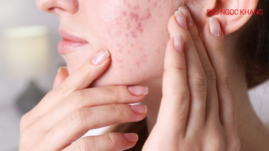 Tái tạo da giúp kích thích quá trình tái sinh tế bào da mới, làm đều màu da