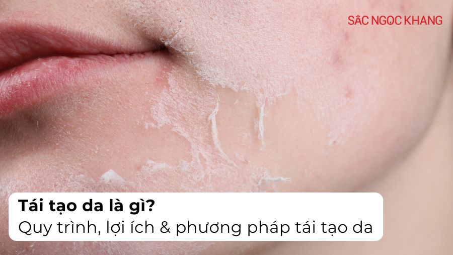 Tái tạo da là gì? Quy trình, phương pháp và lợi ích cho làn da khỏe mạnh