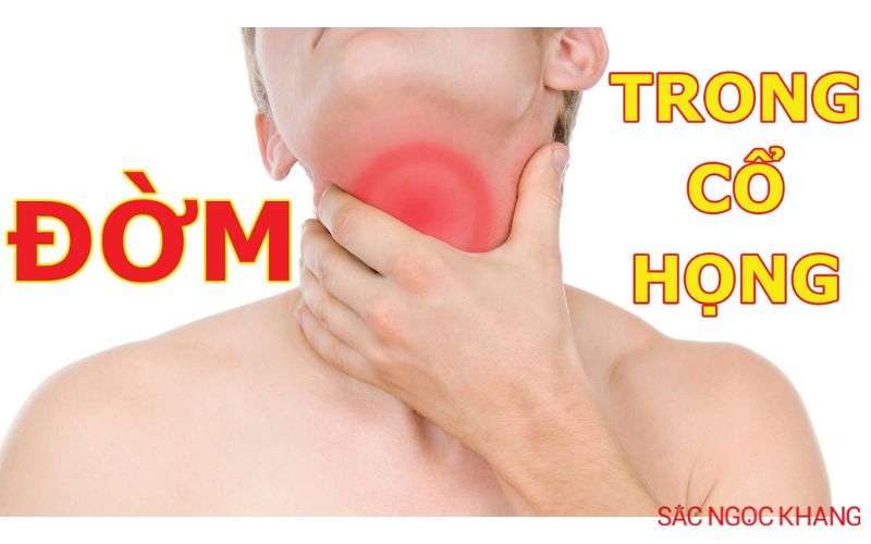 cổ họng lúc nào cũng có đờm là bệnh gì