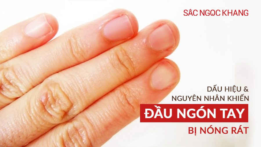 đầu ngón tay bị nóng rát