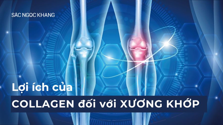 Top 6 lợi ích của Collagen đối với xương khớp bạn đã biết?