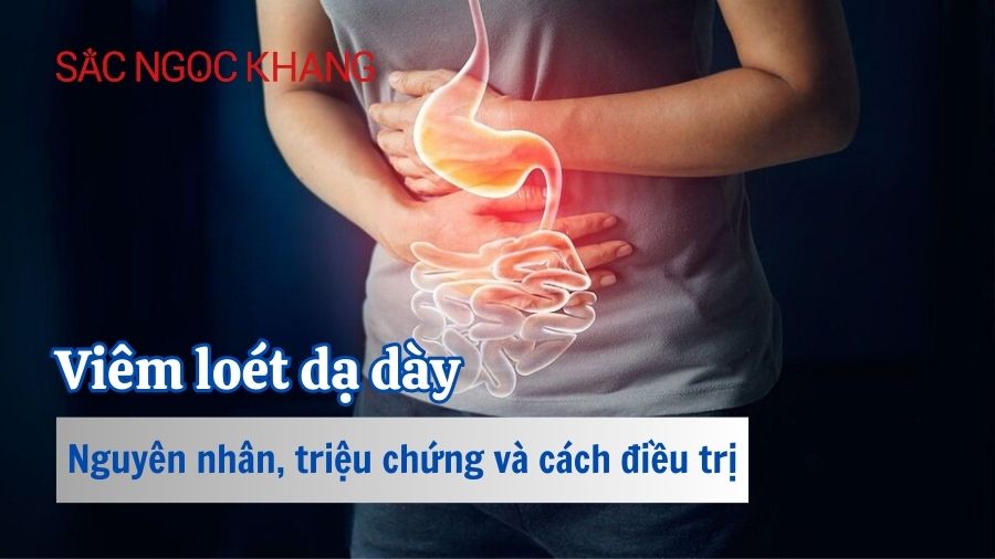 Nguyên nhân gây loét dạ dày