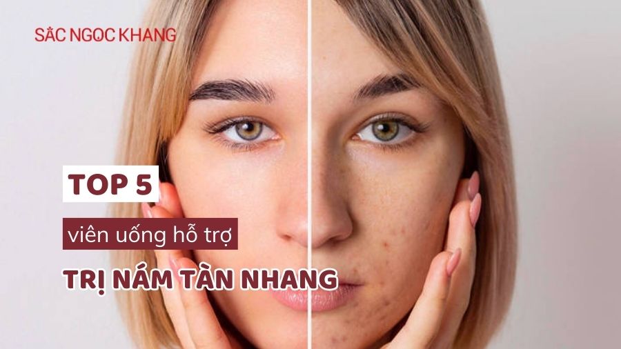 Viên uống hỗ trợ trị nám tàn nhang