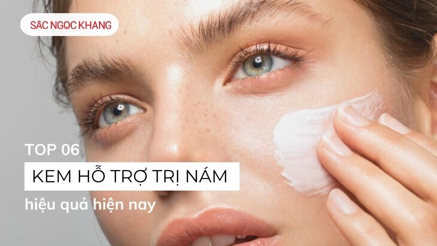 kem hỗ trợ trị nám tàn nhang