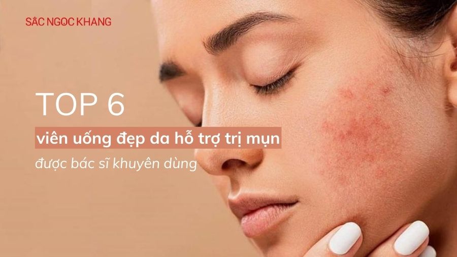 viên uống đẹp da hỗ trợ trị mụn