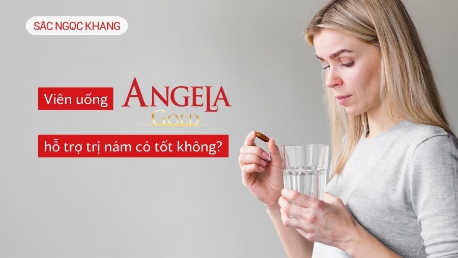 Viên uống hỗ trợ trị nám Angela