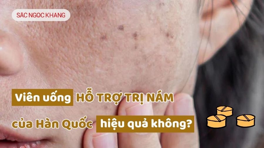 Viên uống hỗ trợ trị nám Hàn Quốc