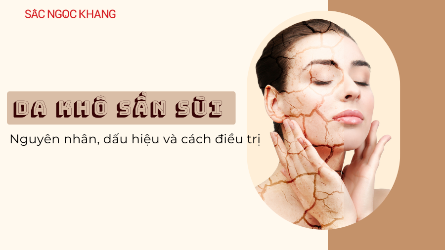 Da khô sần sùi