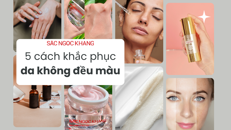 Da không đều màu
